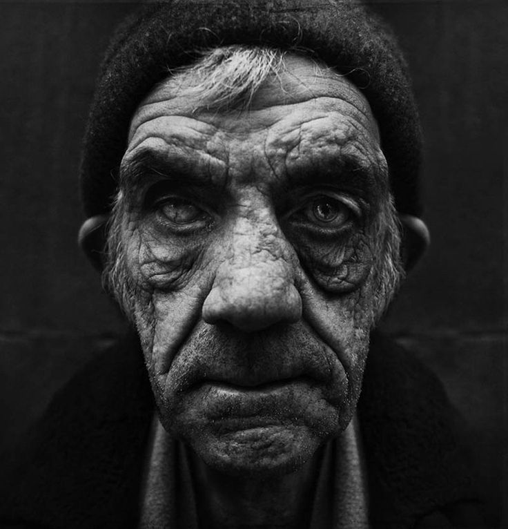 homeless-man-face